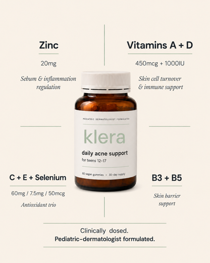 Daily Acne Support for Teens