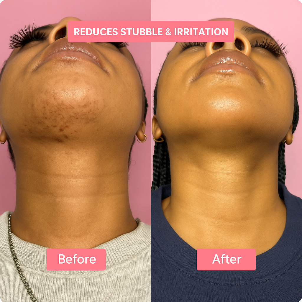 Elara™ - Cyperus Rotundus Skin Serum